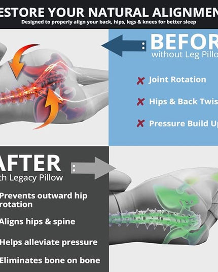 Contour Legacy Leg & Knee Foam Support Pillow - Soothing Relief for Sciatica, Back, Hips, Knees, Joints - As Seen on TV - LeafyLoom